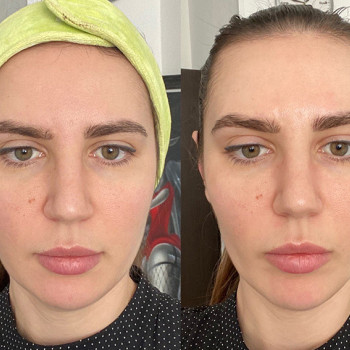 Масаж по Жаке
                    Косметологический центр  Ужгород