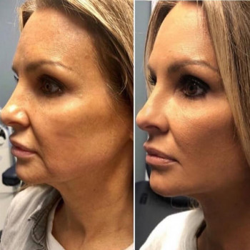 Міофасціальний масаж
                    Косметологический центр  Ужгород