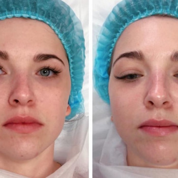 Заспокійлива маска
                    Косметологический центр  Ужгород