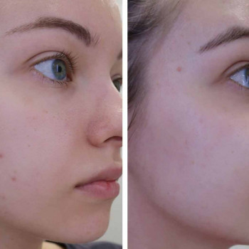 Заспокійлива маска
                    Косметологический центр  Ужгород