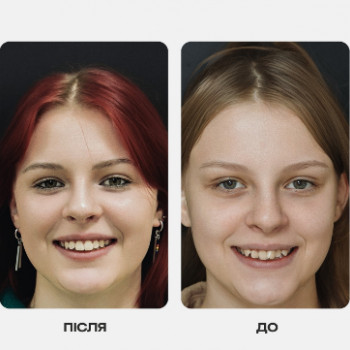 Via Stom, Хмельницький Фото - 5