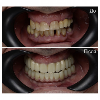 AsProDent, Хмельницкий Фото - 5