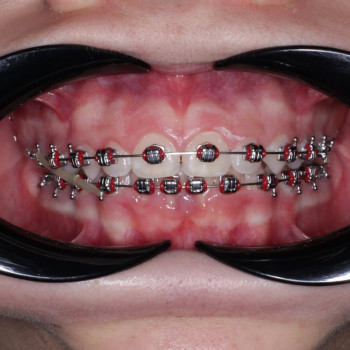 OktaDent, Черновцы Фото - 5