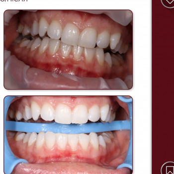 SVdent, Черновцы Фото - 5