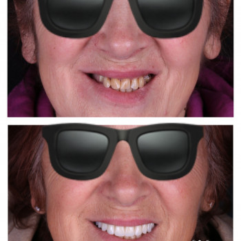 Dental Esthetic Studio, Чернівці Фото - 5