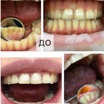 Смайл, Черновцы Фото - 5