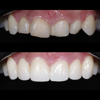 Elit Dent, Черновцы Фото - 5