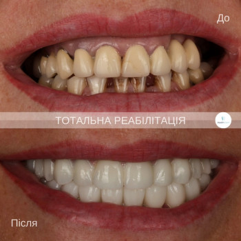 HealthDent, Черновцы Фото - 5