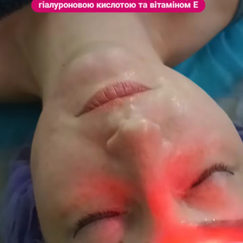 Апаратний масаж для обличчя: RF-ліфтинг
                    Массажист Ирина Днепр