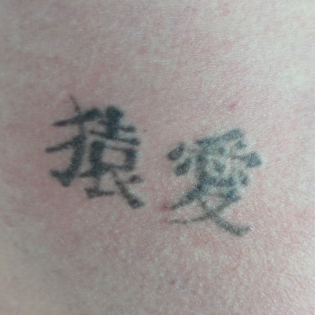 Видаленнятатуберезняки, фото - студія лазерної епіляції Moon laser studio