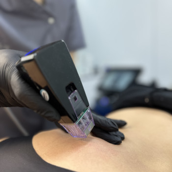 RF ліфтинг
                    Косметологический центр Laser Impulse Тернополь