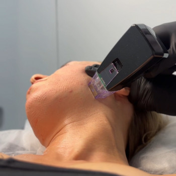 RF ліфтинг
                    Косметологический центр Laser Impulse Тернополь