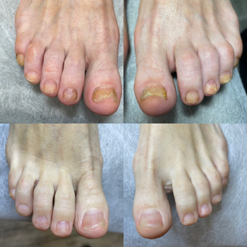 Юлія Симонец, Буча Фото - 1