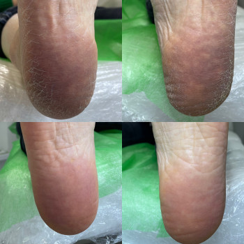 Юлія Симонец, Буча Фото - 2