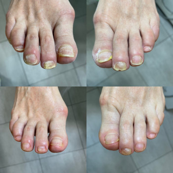 Юлія Симонец, Буча Фото - 3