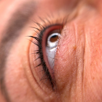 Перманент межреснички спустя пол года
 