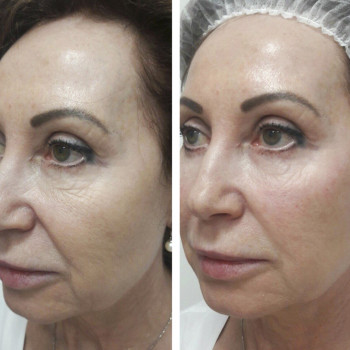 Біорепарація
                    Косметологічний центр  Ужгород