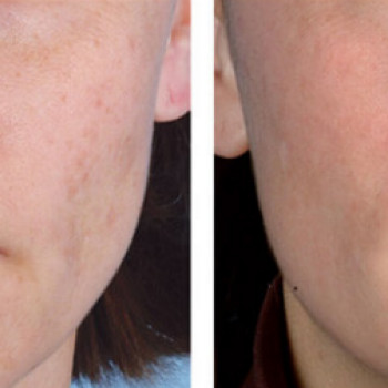 Біорепарація
                    Косметологічний центр  Ужгород