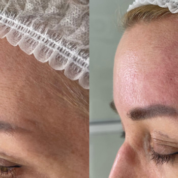 Біорепарація
                    Косметологічний центр  Ужгород