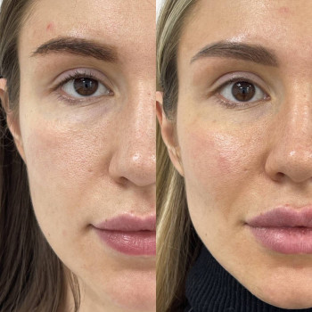 Біорепарація
                    Косметологічний центр  Ужгород