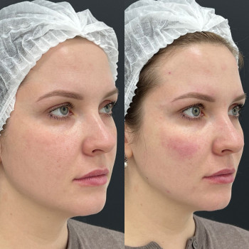 Біоармування
                    Косметологический центр  Ужгород