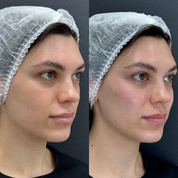 Біоармування
                    Косметологический центр  Ужгород