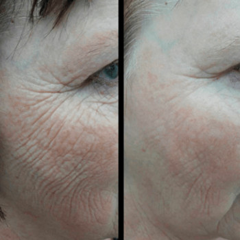 Біоармування
                    Косметологический центр  Ужгород