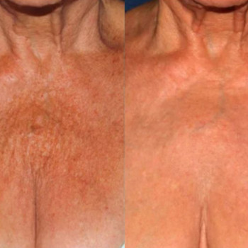 Полінуклеотиди
                    Косметологический центр  Ужгород