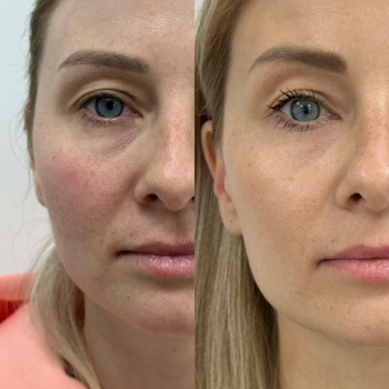 Полінуклеотиди
                    Косметологический центр  Ужгород