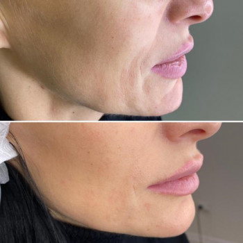 Полінуклеотиди
                    Косметологический центр  Ужгород