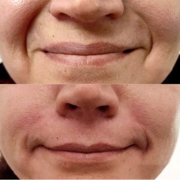 Янтарна кислота
                    Косметологический центр  Ужгород