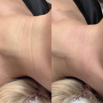 Янтарна кислота
                    Косметологический центр  Ужгород