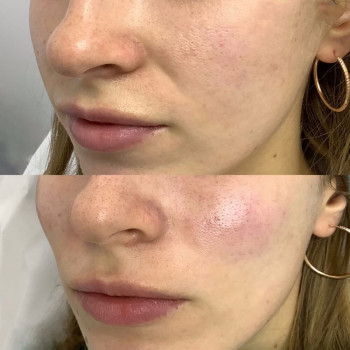 Янтарна кислота
                    Косметологический центр  Ужгород