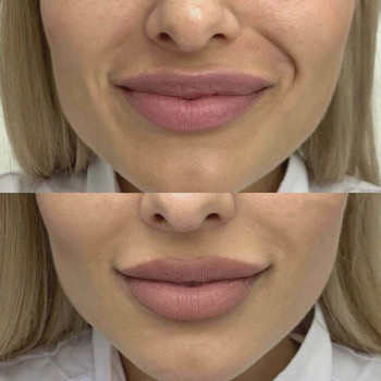 Янтарна кислота
                    Косметологический центр  Ужгород