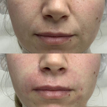 Янтарна кислота
                    Косметологический центр  Ужгород