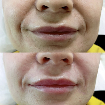 Янтарна кислота
                    Косметологический центр  Ужгород