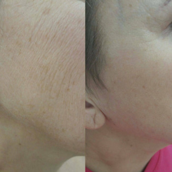 Янтарна кислота
                    Косметологический центр  Ужгород