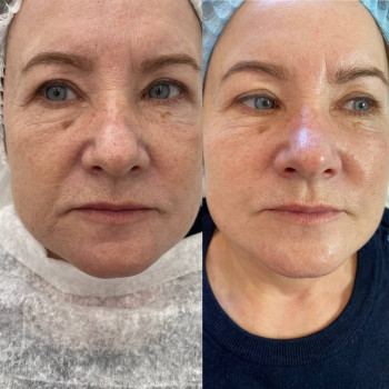 Янтарна кислота
                    Косметологический центр  Ужгород