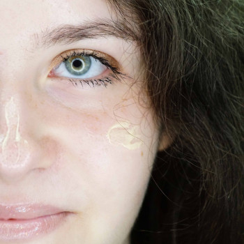 Програма для сухої шкіри
                    Косметологический центр  Ужгород