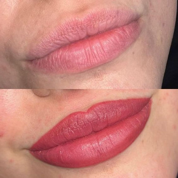 Помадні губи
                    Косметологический центр  Ужгород