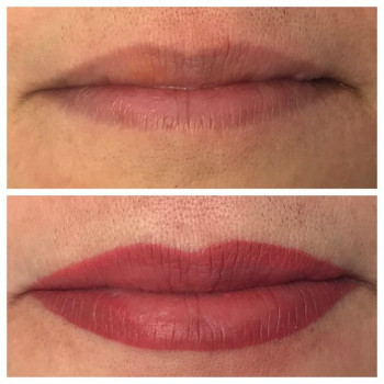 Помадні губи
                    Косметологический центр  Ужгород