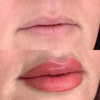 Помадні губи
                    Косметологический центр  Ужгород