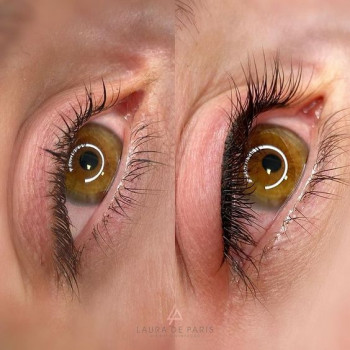 Стрілка
                    Косметологічний центр  Ужгород