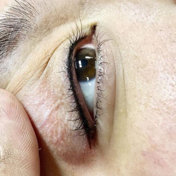 Корекція перманенту
                    Косметологический центр  Ужгород