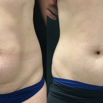 Ліполітики прямі
                    Косметологічний центр  Ужгород