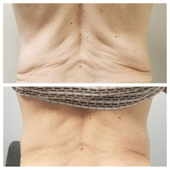 Ліполітики прямі
                    Косметологічний центр  Ужгород