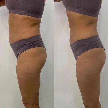 Ліполітики прямі
                    Косметологічний центр  Ужгород