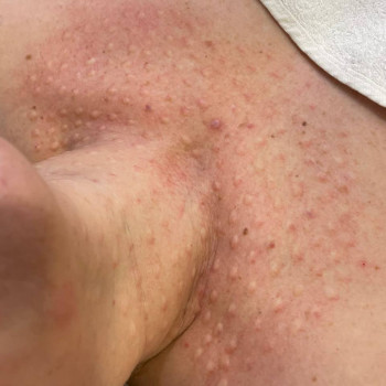 Біоревіталізація тіла
                    Косметологічний центр  Ужгород