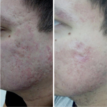 Fusion Repair
                    Косметологічний центр  Ужгород