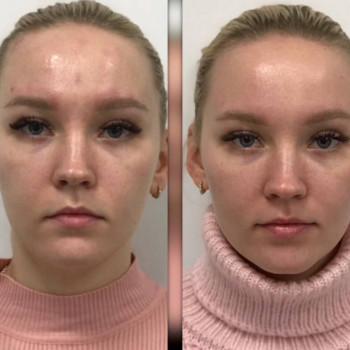 Melanopeel
                    Косметологический центр  Ужгород